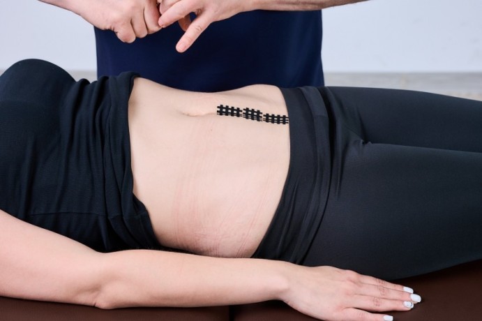 Кросс тейпы BB-Cross Tape (тип В) черный 2,8см*3,6см (120 шт)