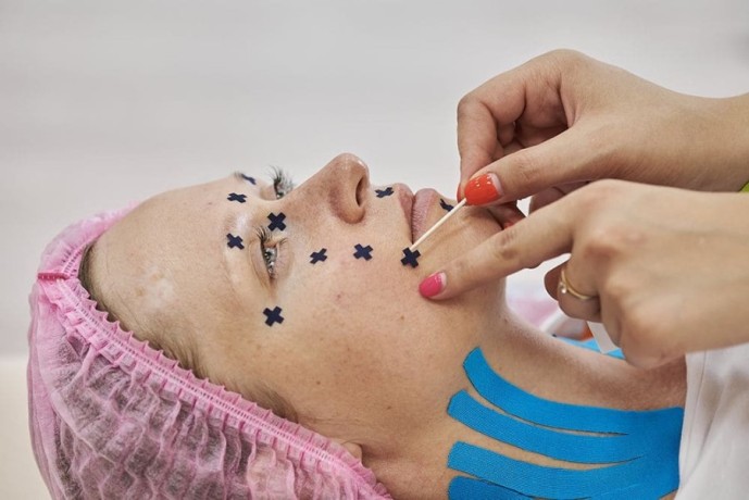 Аку тейпы BB-Acu Tape красный 1см*1см (640 шт)